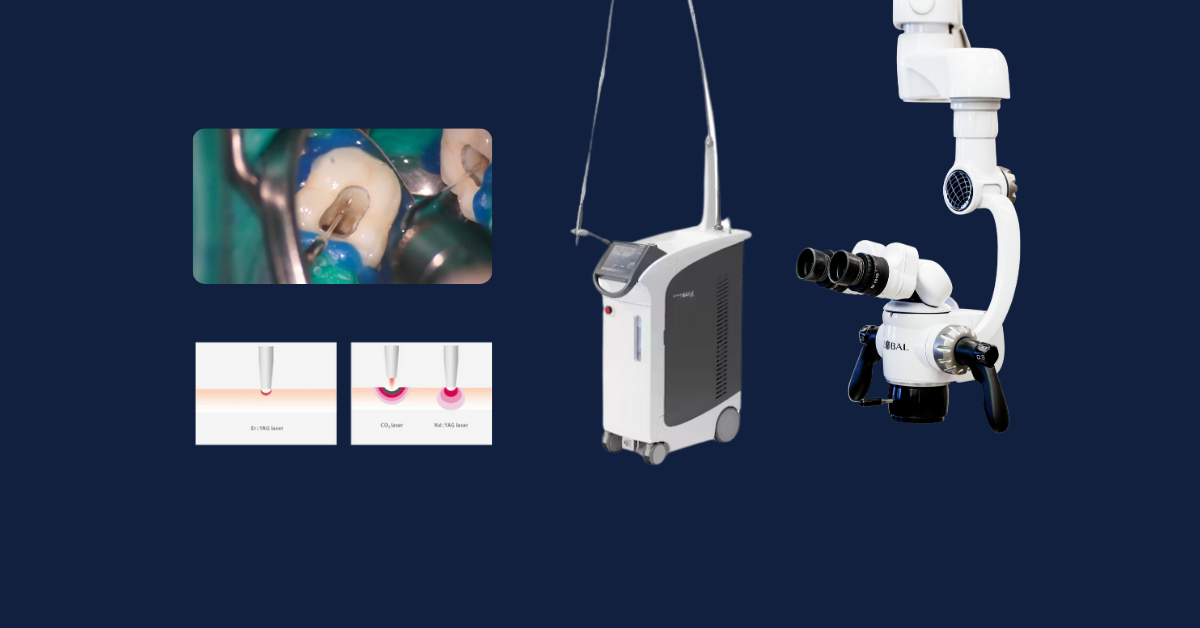 endodontic yag laser dental microscope
