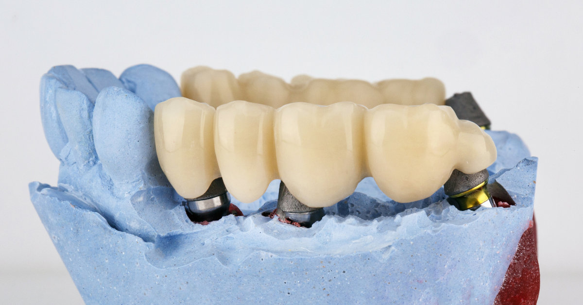 restorative dentistry